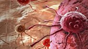 کاهش خطر ابتلا به آلزایمر با داروی درمان سرطان سینه