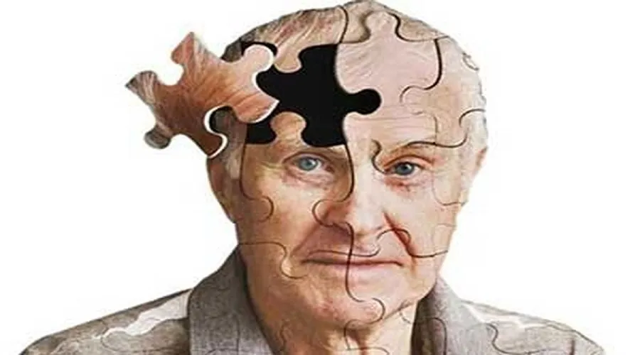 خطر ابتلا به آلزایمر در کمین صاحبان این ۱۰ شغل