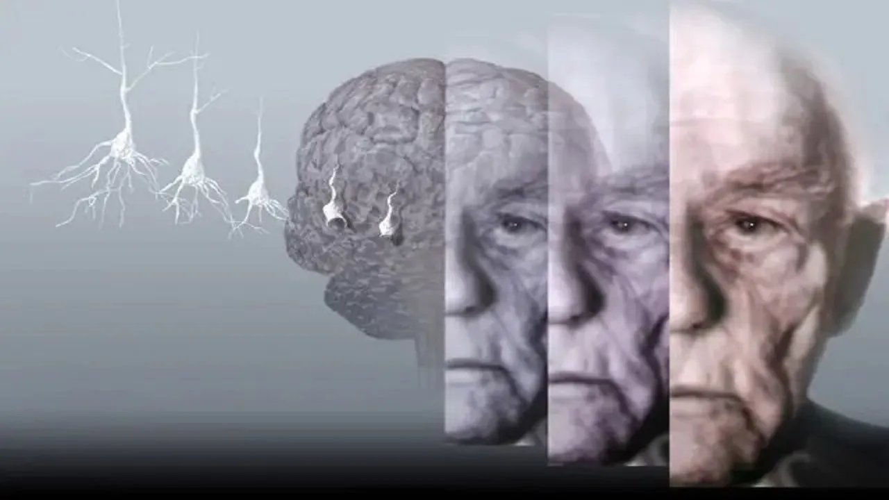 فرمول پیشگیری از آلزایمر
