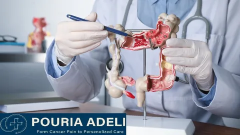 موج هشداردهنده سرطان روده بزرگ در جوانان؛ آیا استرس روانی مقصر اصلی است؟