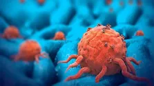 عملکرد امیدوارکننده واکسن «mRNA» در درمان سرطان لوزالمعده