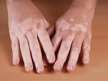 علائم ۱۰ بیماری خاموش و مهلک