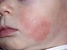 کارانه علی الحساب پرستاران از هفته آینده پرداخت می‌شود