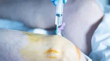 درد فک و گردن هنگام بروز مشکلات قلبی چگونه احساس می‌شود؟