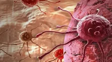 استفاده از دخانیات، یکی از مهمترین علل ابتلاء به سرطان ریه است