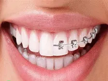 ساخت بیش از ۴.۵ میلیون قرص در هلال احمر طی یک هفته