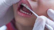 علائم سکته مغزی قریب الوقوع