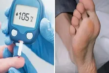 قند نارگیل و کاهش فشار خون و سفتی شریان در افراد مسن