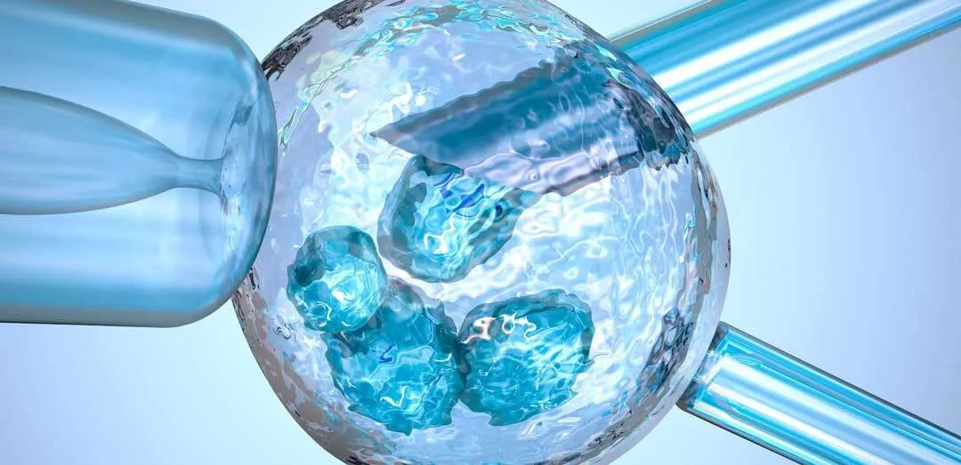 احتمال درمان بیماران HIV با سلول‌های بنیادی