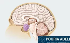 گلیوبلاستوم مولکولی چیست و چه تفاوتی با نوع کلاسیک دارد؟