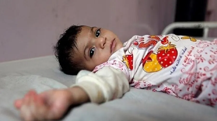 پیش‌بینی بودجه ۳ همتی برای درمان رایگان کودکان زیر ۷ سال