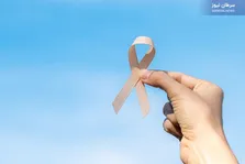 نقش نشانگر CA-۱۲۵ در تشخیص سرطان تخمدان: نتایج مطالعه جدید ۲۰۲۴