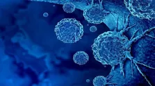 غربالگری رایگان سرطان در کشور / درمان سرطان در ایران همپای دنیا
