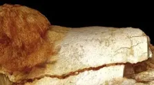۱۳ علامت هشدار دهنده ابتلا به سرطان