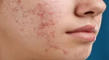 شیر گاو نانوذره دارد، آن هم از نوع مفید!