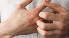 زندگی بدون تیروئید چگونه است؟