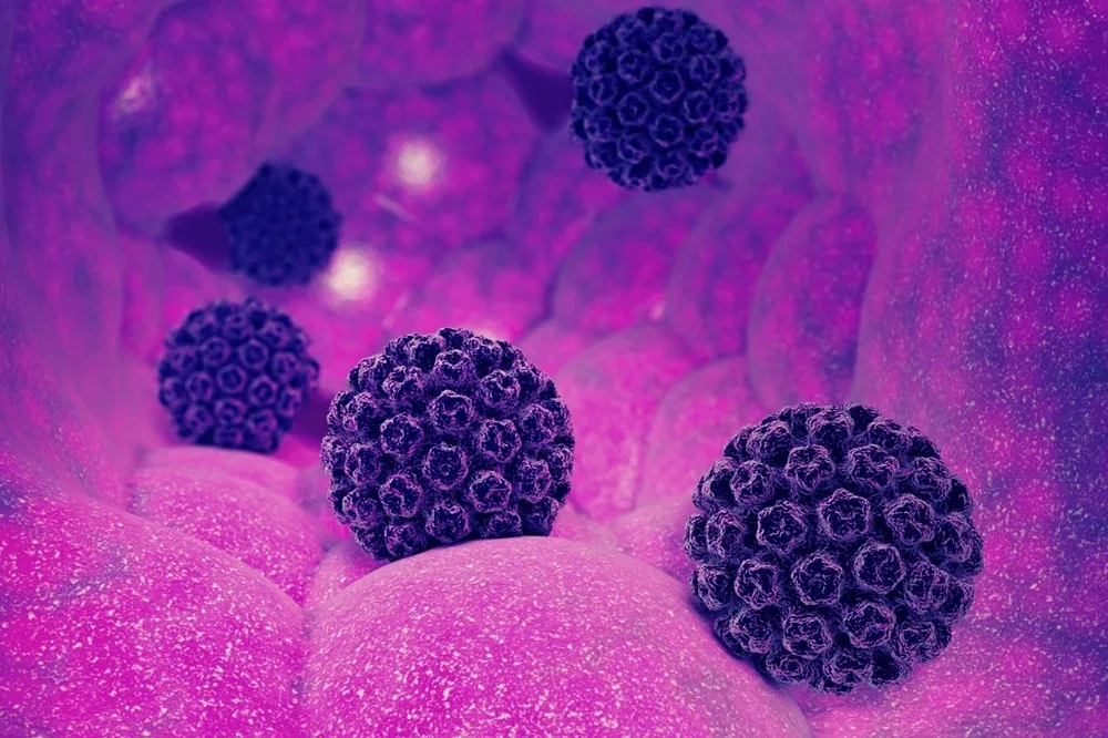 آیا ابتلا به HPV همیشه منجر به سرطان دهانه رحم یا حفره دهان می‌شود؟