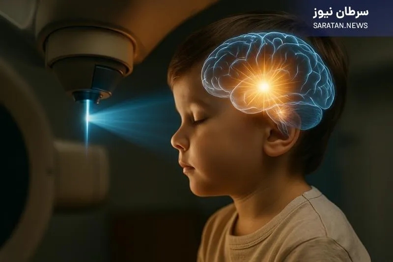رادیوتراپی هوشمندتر برای کودکان مبتلا به گلیوم منتشر پونز