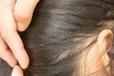 درستی و نادرستی برخی تصورات رایج پزشکی