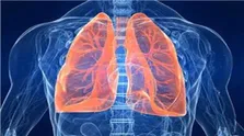 آمیوانتاماب در سرطان ریه با جهش اگزون ۲۰ EGFR؛ نتایج نهایی مطالعه PAPILLON چه می‌گویند؟