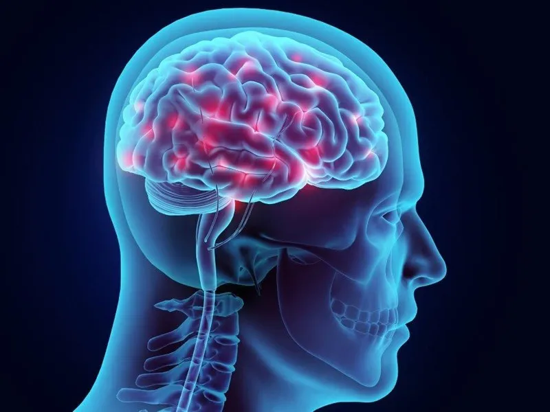 آلودگی هوا با افزایش خطر سکته مغزی مرتبط است