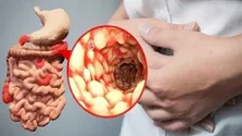 بلند قدها سرطان می‌گیرند؟