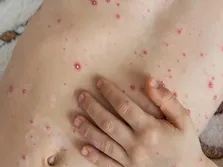 امیدها و هشدار‌های آینده پزشکی کشور
