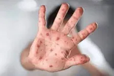 پیاده روی کوتاه در افراد ۸۵ سال به بالا و افزایش طول عمر