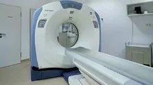 کاهش مرگ و میر با برنامه غربالگری سرطان روده بزرگ
