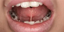 چالش های رشته بیهوشی در کشور/ درآمد کم و استرس بالا
