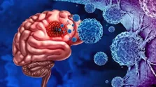 روشی نویدبخش برای مقابله با سرطان تهاجمی مغز