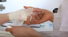 علت عرق زیاد سر و صورت و راه‌های درمان آن