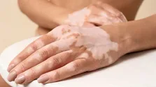 سبک زندگی چگونه به بارداری سالم کمک می‌کند