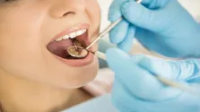۱۴ خدمت دندانپزشکی تحت پوشش بیمه سلامت+جزئیات