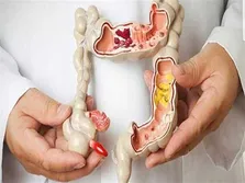 غربالگری سرطان پستان در کشور به ۲۳.۵ درصد رسید