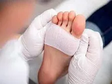 تغییرات اقلیمی با بروز بیشتر عفونت های ریوی قارچی مرتبط است