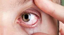 عارضه های خیره شدن به صفحه گوشی/ هر دقیقه ۲۰ پلک بزنید