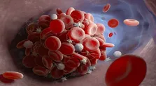 تأیید داروی جدید روومنیب برای درمان لوسمی مقاوم با جابجایی KMT2A توسط FDA