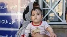 افزودن شیر به فنجان قهوه خاصیت ضدالتهابی دارد