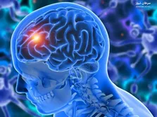 کدام رژیم غذایی باعث خودکشی سلول‌های سرطانی مغز می‌شود؟