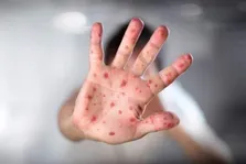 کرونا در جهان/فهرست ۱۰ کشور با بالاترین آمار مبتلایان