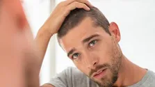 استرس عامل اصلی ریزش مو