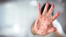 برای مقاوم‌سازی ۴۰ هزار تخت بیمارستانی فرسوده ۱۸۰ همت بودجه نیاز است
