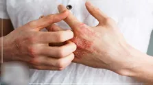 از بیماری خاموش پوکی استخوان چه می‌دانید؟