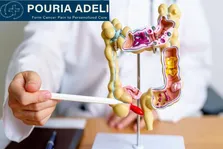 تحولی در درمان سرطان کولورکتال MSS/pMMR: تحلیل داده‌های فاز ۱/۲ ترکیب EO۴۰۱۰ و Nivolumab در نشست ASCO ۲۰۲۵