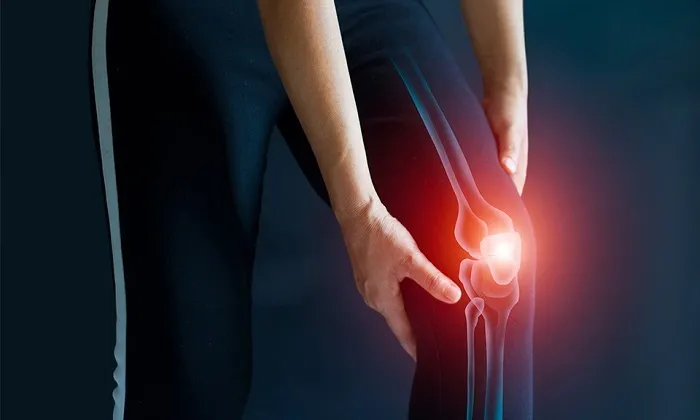 زانودرد عصبی چیست و چگونه به آن دچار نشویم؟