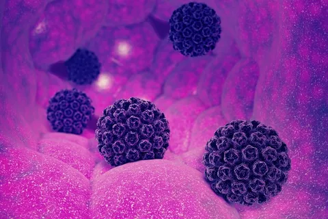 آیا ابتلا به HPV همیشه منجر به سرطان دهانه رحم یا حفره دهان می‌شود؟