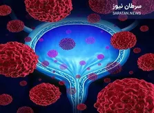 تحول بزرگ در درمان سرطان مثانه پیشرفته با انفورتوماب ودوتین