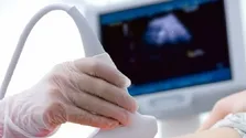 اقدامات هلال احمر در تولید تجهیزات پزشکی/ساخت ۳ میلیون و ۸۰۰ هزار سرنگ در یک هفته