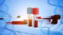 ایران جزو چند کشور سازنده کیت تشخیص DNA است